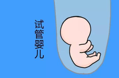 时差培养箱